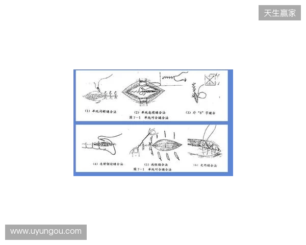 广州豹官方:杨浩眉弓伤口缝合30余针,预计5-7天后拆线 广州豹官方:杨浩眉弓伤口缝合30余针,预计5-7天后拆线